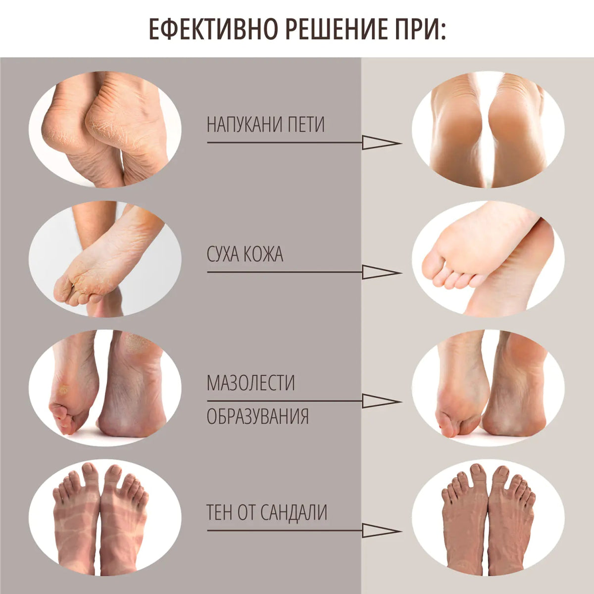 Kрем за крака с 10% урея и 10% aha 75ml - CAMCO Ltd.